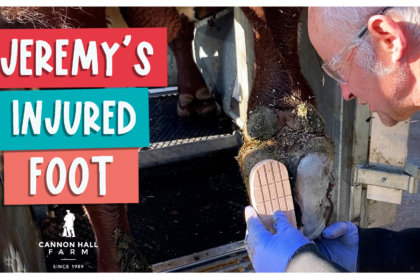 Jeremy's injured foot